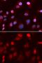 ATPase Copper Transporting Beta antibody, GTX30077, GeneTex, Immunofluorescence image 