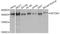 Histone-lysine N-methyltransferase SETDB1 antibody, A6145, ABclonal Technology, Western Blot image 