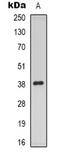 Progestin And AdipoQ Receptor Family Member 5 antibody, orb338844, Biorbyt, Western Blot image 