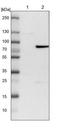 Zinc finger and BTB domain-containing protein 7B antibody, NBP1-88077, Novus Biologicals, Western Blot image 