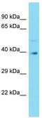 G Protein Pathway Suppressor 2 antibody, TA338174, Origene, Western Blot image 