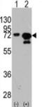 Heat shock 70 kDa protein 1A/1B antibody, abx033486, Abbexa, Western Blot image 