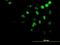 Homeobox A11 antibody, H00003207-M08, Novus Biologicals, Immunocytochemistry image 