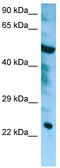 Charged Multivesicular Body Protein 6 antibody, TA337987, Origene, Western Blot image 