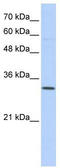 Sideroflexin 1 antibody, TA338616, Origene, Western Blot image 