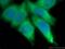 Heme Oxygenase 2 antibody, 14817-1-AP, Proteintech Group, Immunofluorescence image 