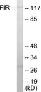 FERM, ARH/RhoGEF And Pleckstrin Domain Protein 2 antibody, EKC1656, Boster Biological Technology, Western Blot image 
