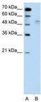 WW Domain Containing E3 Ubiquitin Protein Ligase 2 antibody, TA329808, Origene, Western Blot image 