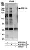 Zinc finger protein 106 antibody, A301-527A, Bethyl Labs, Immunoprecipitation image 