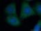 Optineurin antibody, 60293-1-Ig, Proteintech Group, Immunofluorescence image 