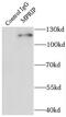 Myosin Phosphatase Rho Interacting Protein antibody, FNab05296, FineTest, Immunoprecipitation image 