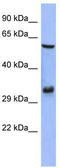 FOS Like 1, AP-1 Transcription Factor Subunit antibody, TA329253, Origene, Western Blot image 