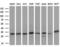 Succinate Dehydrogenase Complex Iron Sulfur Subunit B antibody, LS-C791481, Lifespan Biosciences, Western Blot image 
