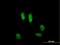Inactive ubiquitin-specific peptidase 39 antibody, H00010713-B01P, Novus Biologicals, Immunofluorescence image 