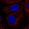 Coiled-Coil Domain Containing 93 antibody, PA5-62935, Invitrogen Antibodies, Immunofluorescence image 