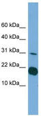 Interleukin-1 family member 5 antibody, TA330956, Origene, Western Blot image 