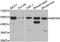 Mitogen-Activated Protein Kinase 9 antibody, A1251, ABclonal Technology, Western Blot image 