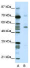 Coronin 1A antibody, TA343655, Origene, Western Blot image 