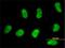 SWI/SNF Related, Matrix Associated, Actin Dependent Regulator Of Chromatin, Subfamily D, Member 2 antibody, H00006603-M02, Novus Biologicals, Immunocytochemistry image 