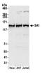 Stromal Antigen 1 antibody, A300-157A, Bethyl Labs, Western Blot image 