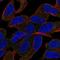 Solute Carrier Family 44 Member 5 antibody, PA5-61522, Invitrogen Antibodies, Immunofluorescence image 