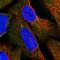 Human Chorionic gonadotrophin antibody, HPA038925, Atlas Antibodies, Immunocytochemistry image 
