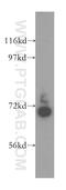 Leucine Rich Repeats And Calponin Homology Domain Containing 3 antibody, 15800-1-AP, Proteintech Group, Western Blot image 