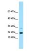 RAP2B, Member Of RAS Oncogene Family antibody, NBP1-98510, Novus Biologicals, Western Blot image 