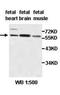 Actin Binding LIM Protein Family Member 2 antibody, orb77712, Biorbyt, Western Blot image 