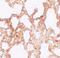 Zinc Finger MYM-Type Containing 1 antibody, PA5-21089, Invitrogen Antibodies, Immunohistochemistry paraffin image 
