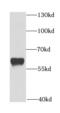 DNA Methyltransferase 1 Associated Protein 1 antibody, FNab02421, FineTest, Western Blot image 