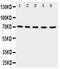 Neuregulin 1 antibody, PA1969, Boster Biological Technology, Western Blot image 