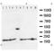 C-C Motif Chemokine Receptor 10 antibody, orb47958, Biorbyt, Western Blot image 