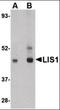Platelet-activating factor acetylhydrolase IB subunit alpha antibody, orb87339, Biorbyt, Western Blot image 