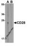 CD28 antibody, 8683, ProSci, Western Blot image 