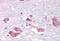 Melanin Concentrating Hormone Receptor 1 antibody, NBP1-02408, Novus Biologicals, Immunohistochemistry paraffin image 