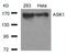 Mitogen-Activated Protein Kinase Kinase Kinase 5 antibody, 79-333, ProSci, Western Blot image 