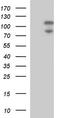 Phosphatidate phosphatase LPIN2 antibody, TA590249, Origene, Western Blot image 