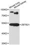 Zinc Finger And BTB Domain Containing 21 antibody, STJ114660, St John