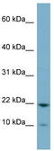 Desumoylating Isopeptidase 1 antibody, TA339331, Origene, Western Blot image 