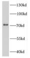 DEAD-Box Helicase 3 Y-Linked antibody, FNab02307, FineTest, Western Blot image 
