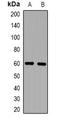 ZFP91 Zinc Finger Protein antibody, orb382672, Biorbyt, Western Blot image 