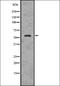 Aldehyde dehydrogenase, mitochondrial antibody, orb336664, Biorbyt, Western Blot image 