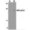 Placenta-specific protein 4 antibody, MBS150528, MyBioSource, Western Blot image 