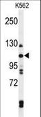 Telomere Maintenance 2 antibody, LS-C161799, Lifespan Biosciences, Western Blot image 