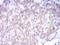 Neurotrophic Receptor Tyrosine Kinase 2 antibody, NBP2-52524, Novus Biologicals, Immunohistochemistry frozen image 