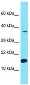 Uncharacterized protein C8orf78 antibody, TA334795, Origene, Western Blot image 