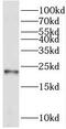 Receptor Accessory Protein 1 antibody, FNab07229, FineTest, Western Blot image 