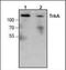 Neurotrophic Receptor Tyrosine Kinase 1 antibody, orb88186, Biorbyt, Western Blot image 