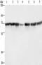 Lamin B1 antibody, TA349381, Origene, Western Blot image 